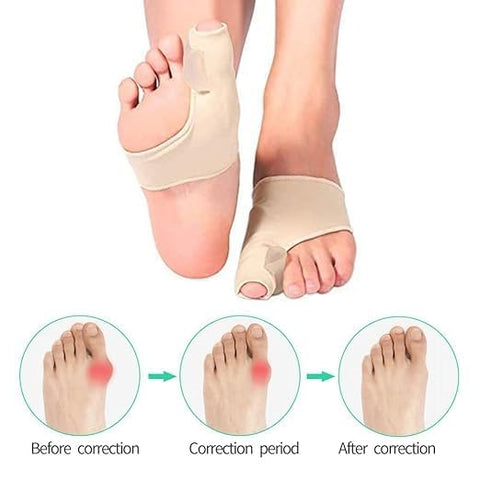 Correcteur Hallux Valgus jour & nuit – soulagement et alignement du gros orteil.