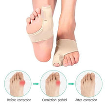 Correcteur Hallux Valgus jour & nuit – soulagement et alignement du gros orteil.
