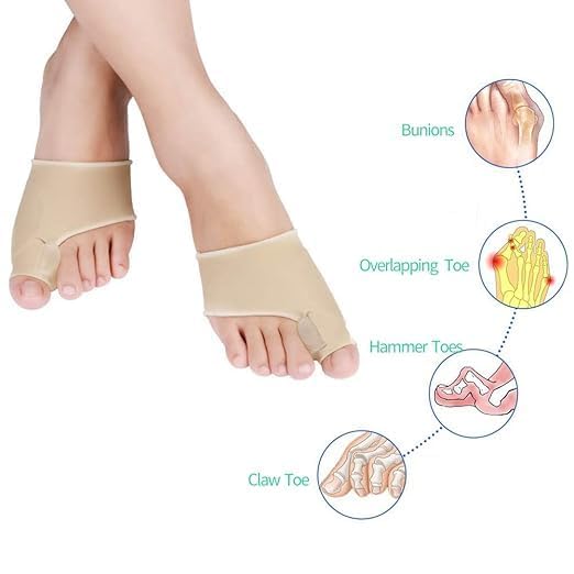 Correcteur Hallux Valgus jour et nuit, redresse-orteil pour gros orteil, manchons protecteurs pour soulagement des douleurs liées à l’hallux valgus et aux orteils en marteau, 1 paire