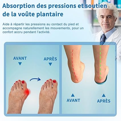 Semelles Sofela OrthoFlex Hallux Valgus, confort toute la journée sans douleur (Bleu, 35-38, 1 paire)